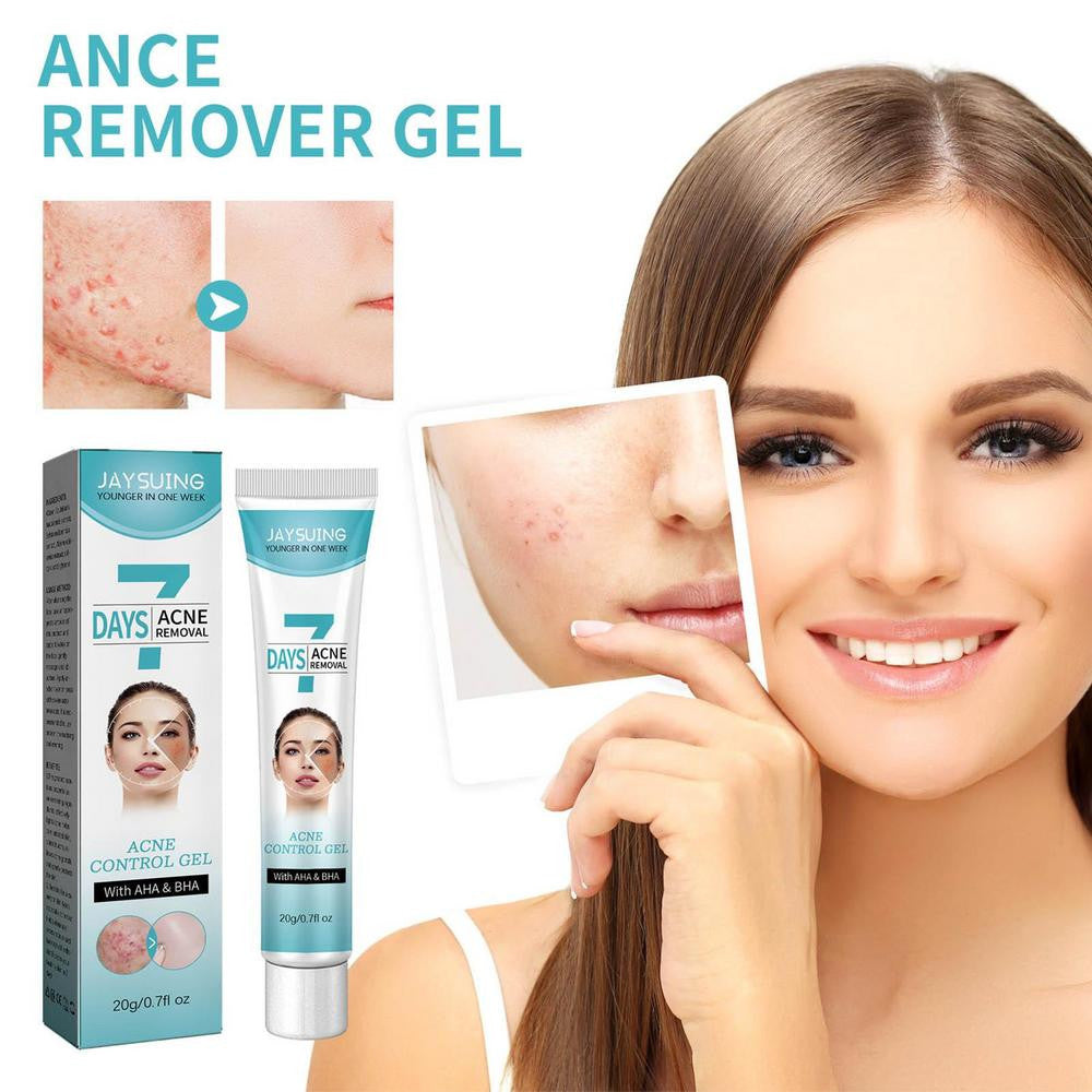 🌿 Crema Facial para combatir el Acné Tratamiento Fk23b39