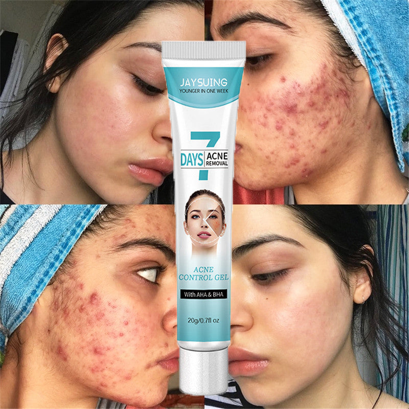 🌿 Crema Facial para combatir el Acné Tratamiento Fk23b39