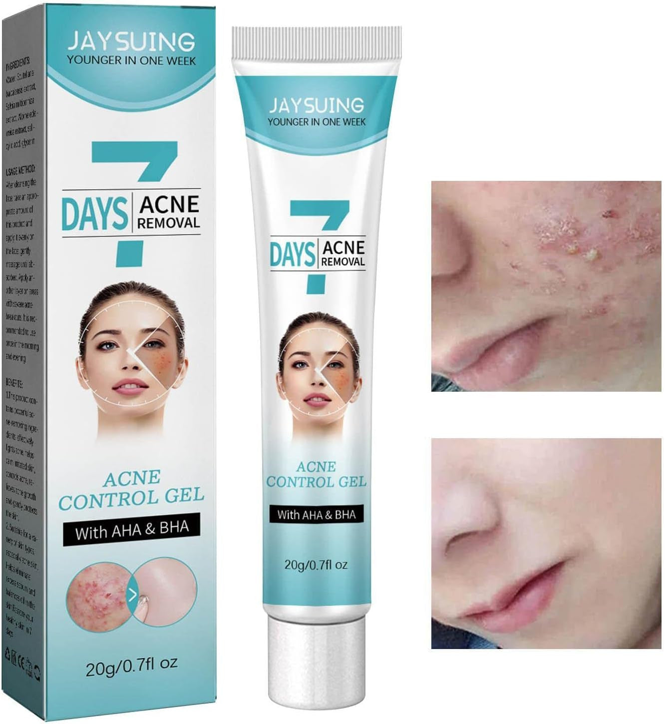 🌿 Crema Facial para combatir el Acné Tratamiento Fk23b39